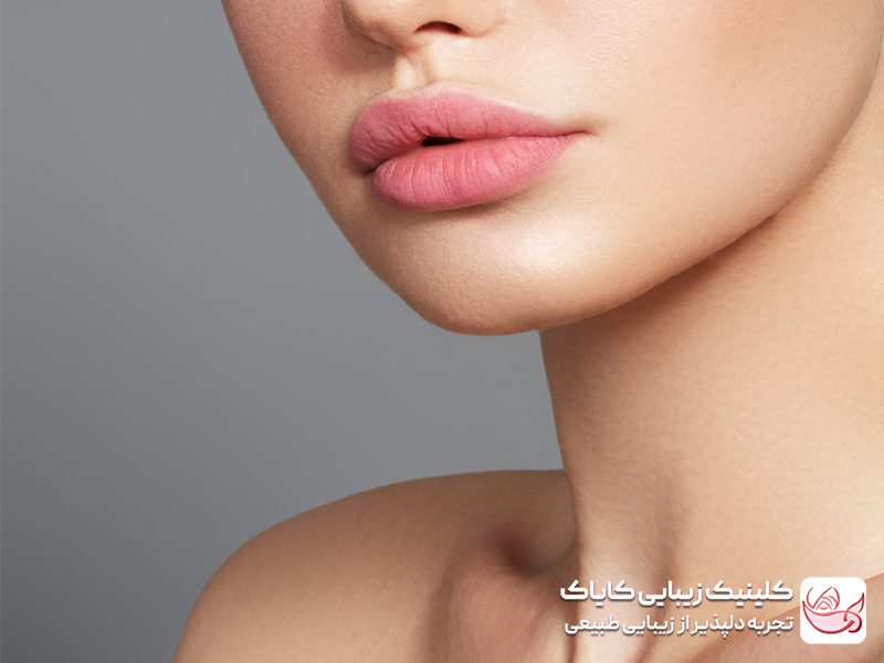 فیلر لب مدل عروسکی - عوارض فیلر لب