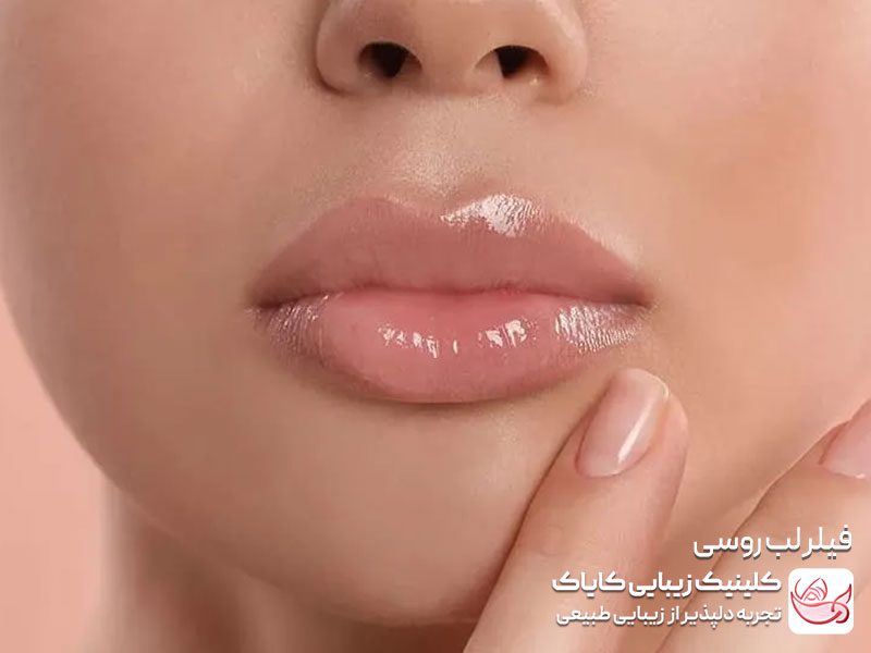 فیلر لب روسی