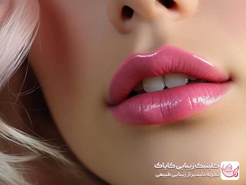 بهترین برند فیلر لب بزرگ کردن لب‌ کم حجم: درمان‌هایی برای حجم دادن و فرم‌ دهی لب
