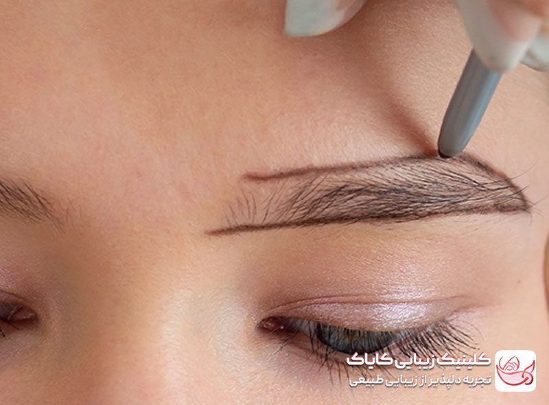 کاشت ابرو در پاسداران: راهنمای کامل، مراحل، هزینه‌ها و نتایج قبل و بعد