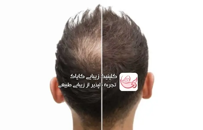 نشانه های نیاز به اسکلاپ تراپی