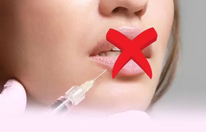 چه کسانی کاندید مناسبی برای فیلر لب نیستند