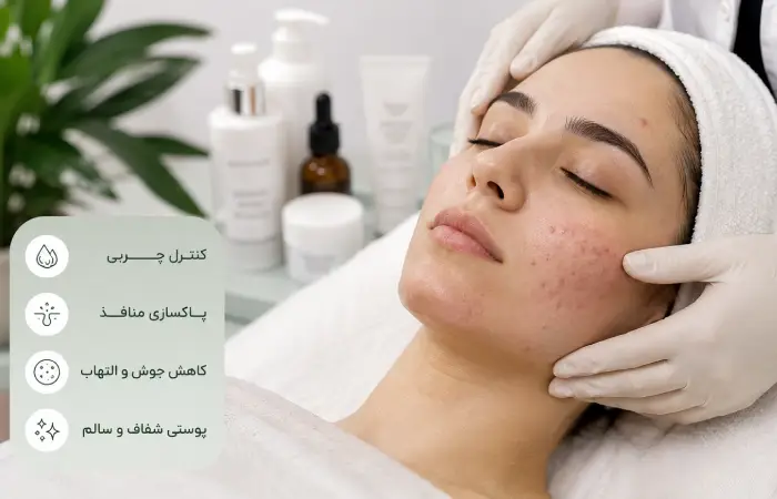 فیشیال پوست چرب