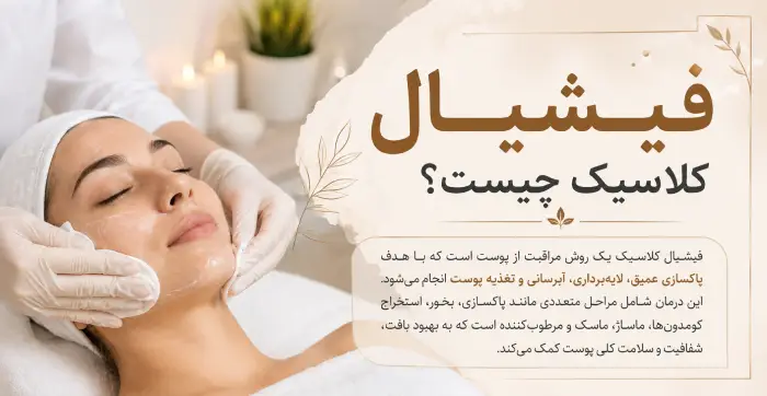 فیشیال کلاسیک