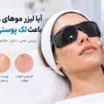 آیا لیزر موهای زائد صورت باعث لک پوستی می‌شود؟ بررسی علمی و راهکارها