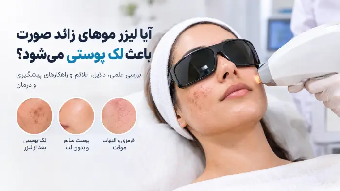 آیا لیزر موهای زائد صورت باعث لک پوستی میشود