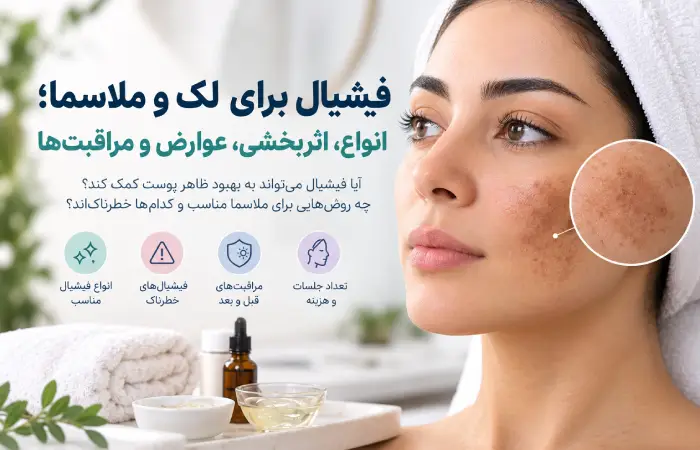 فیشیال برای لک و ملاسما