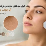 لیزر موهای نازک و کرک صورت جواب می‌دهد؟ (راهنمای کامل ۱۴۰۵)