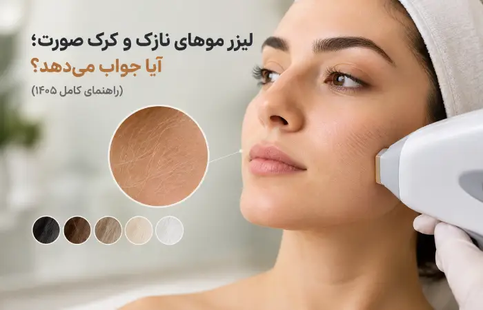 لیزر موهای نازک و کرک صورت