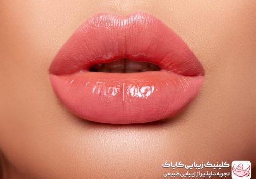 فیلر لب قلبی