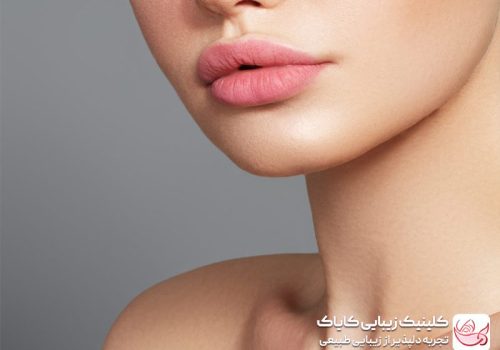 فیلر لب مدل عروسکی - عوارض فیلر لب