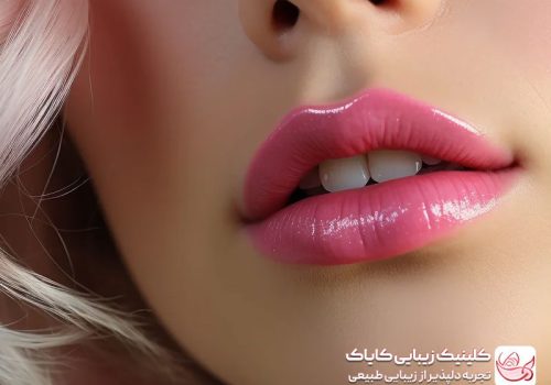بهترین برند فیلر لب بزرگ کردن لب‌ کم حجم: درمان‌هایی برای حجم دادن و فرم‌ دهی لب